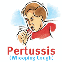 Pertussis (Whooping Cough)