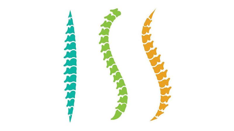 Scoliosis Screening Logo