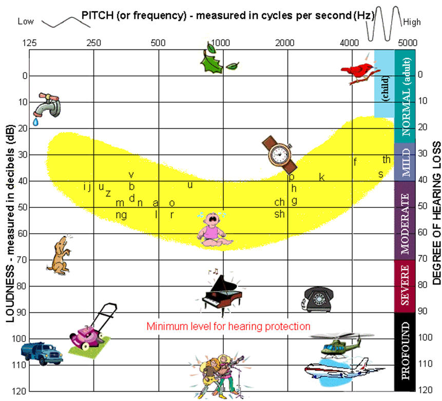 Speech Banana Audiogram