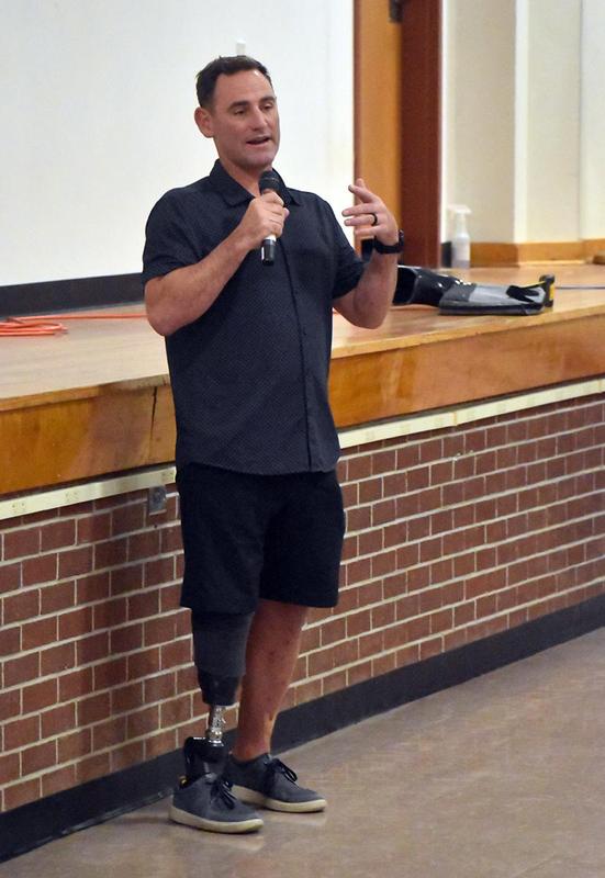 A man with a prosthetic leg speaks while standing on a stage with a casual outfit.